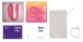 We-Vibe - Sync Lite 情侶共用震動器 - 粉紅色 照片-12