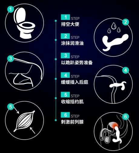 Erocome - 獵戶座 遙控版 - 前列腺按摩器 照片
